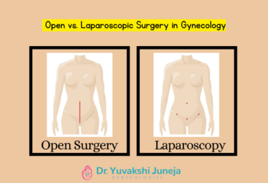 choosing-the-right-path-open-vs-laparoscopic-surgery-in-gynecology