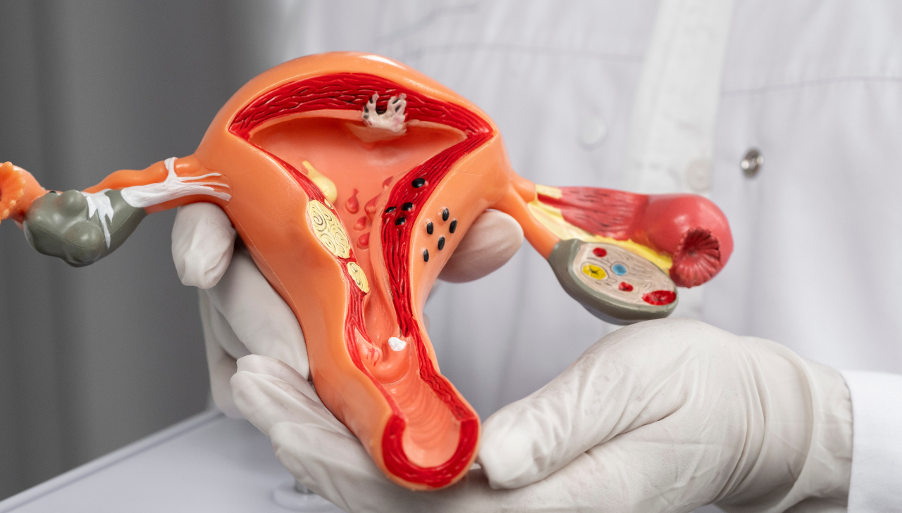 fibroids-during-pregnancy-causes-risks-and-treatment